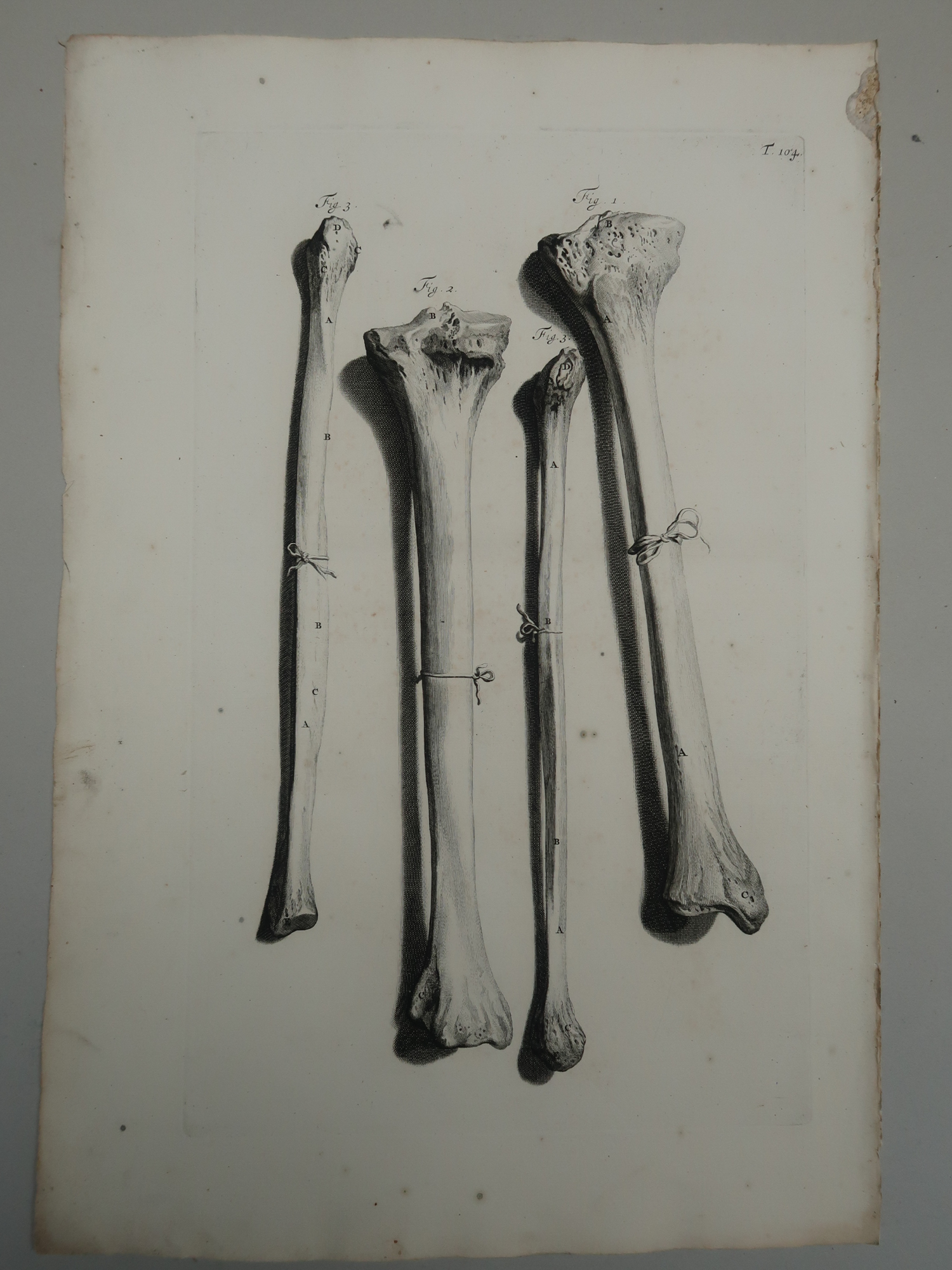 , Antique Print-T.104.-ANATOMY-TIBIA-FIBULA-LOWER-LEG-BONES-Lairesse-Bidloo-1728, Pictura Antique Prints