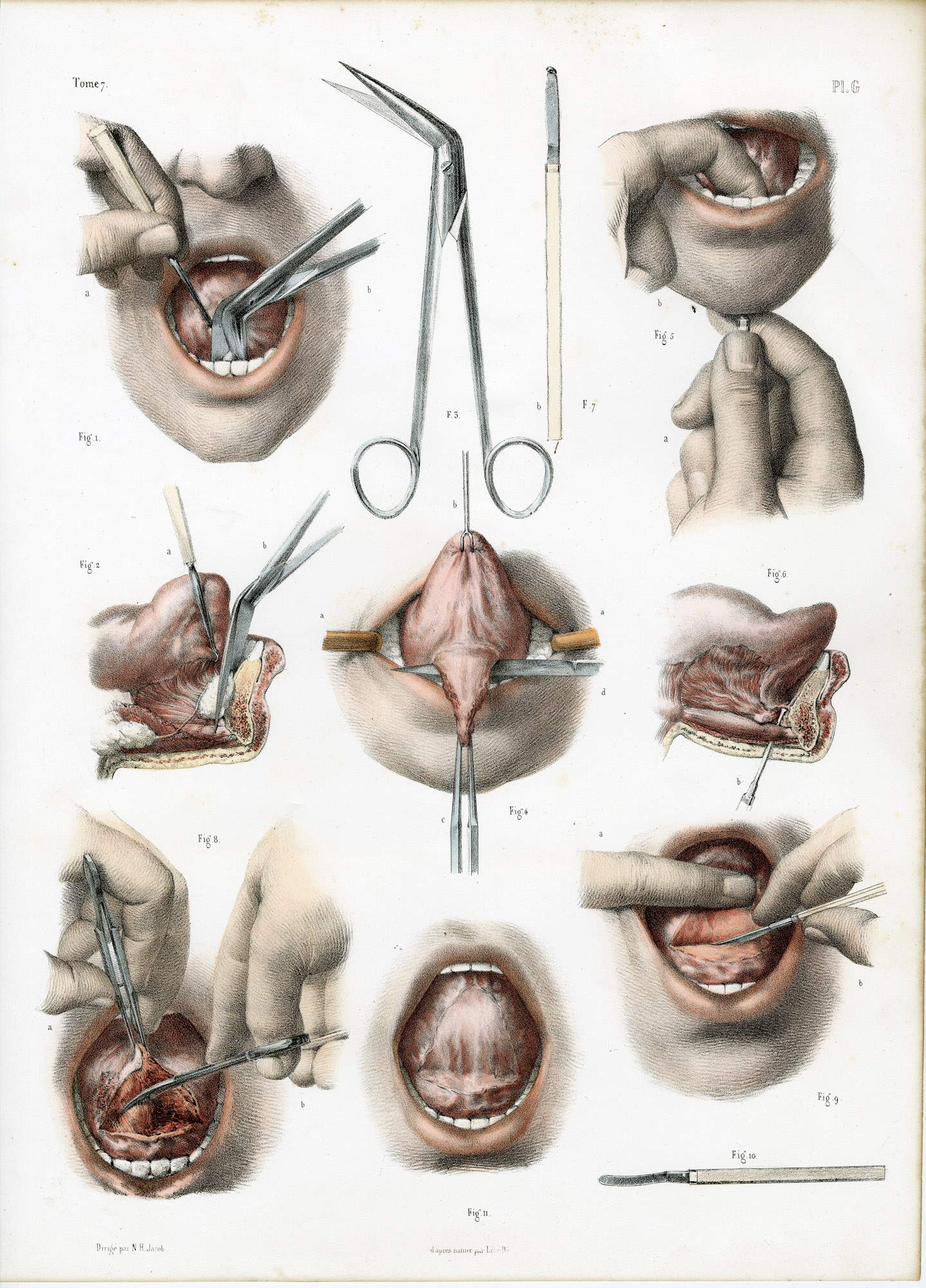 Pictura 14046 416x578 Catalogue-Bourgery-Human anatomy
