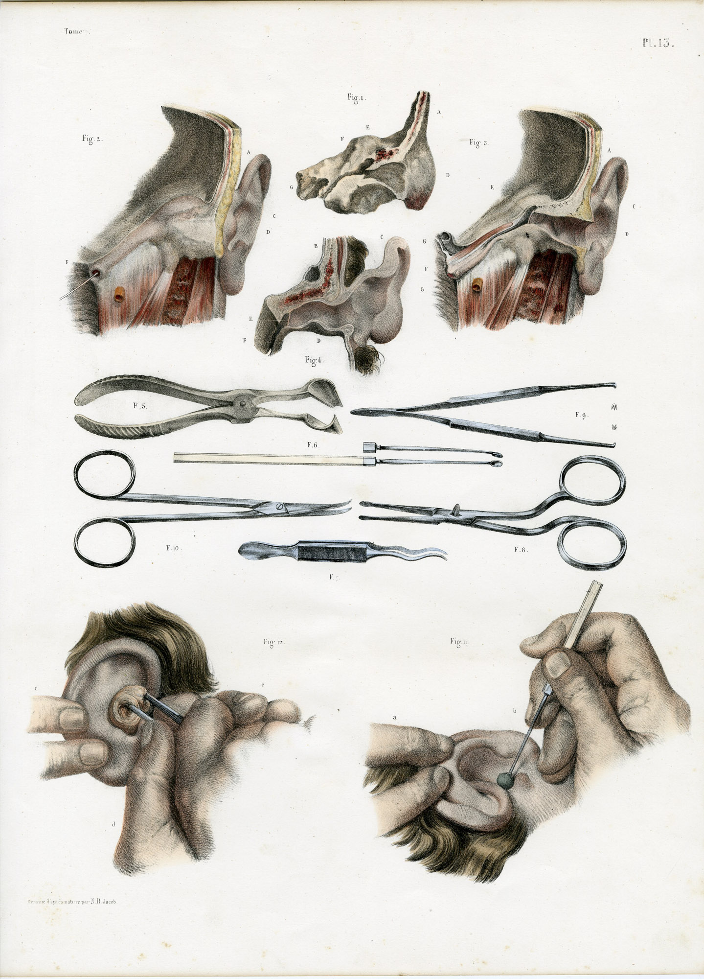 Pictura 14048 416x578 Catalogue-Bourgery-Human anatomy - Image 3