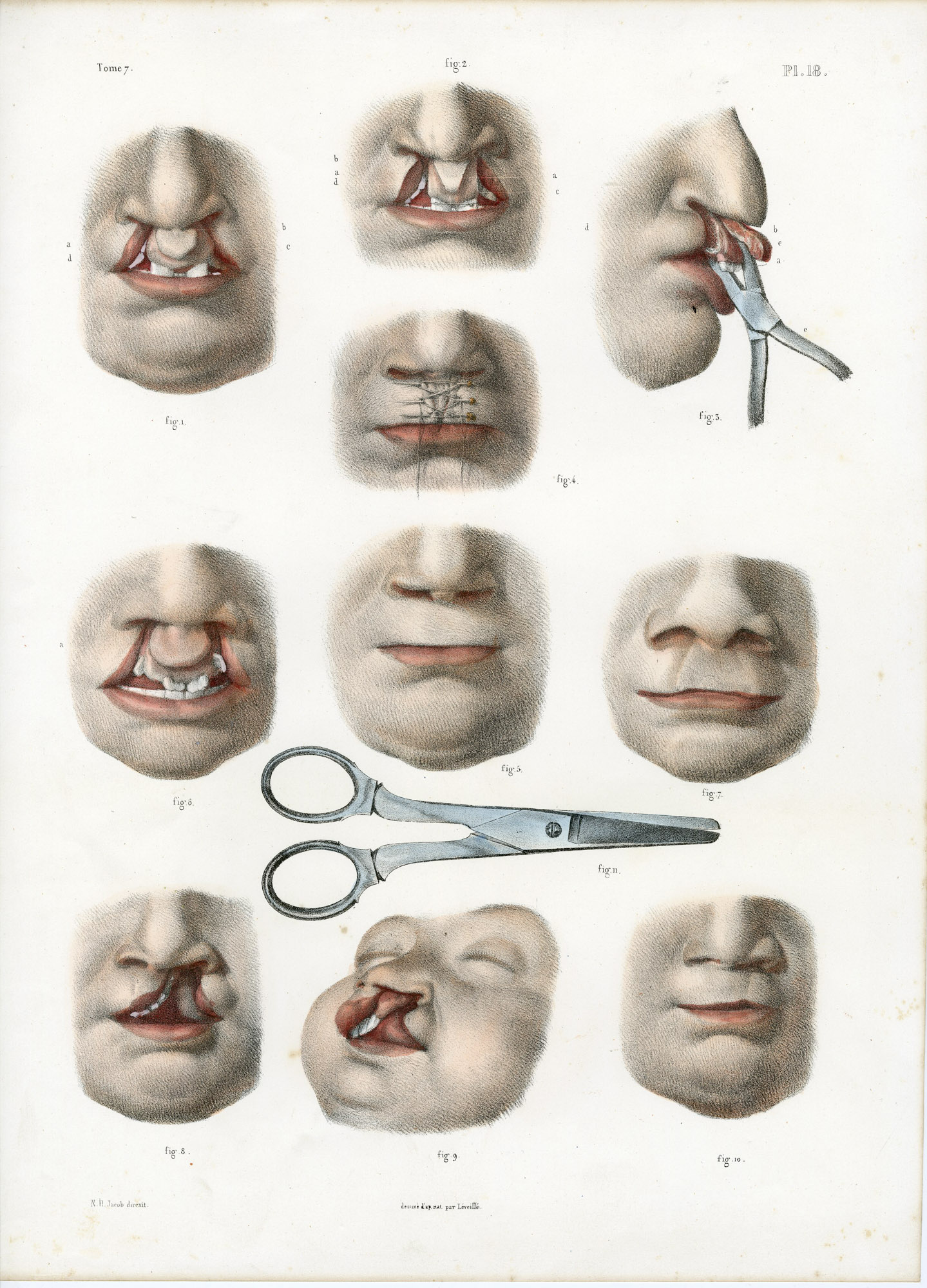 Pictura 14049 416x578 Catalogue-Bourgery-Human anatomy - Image 4