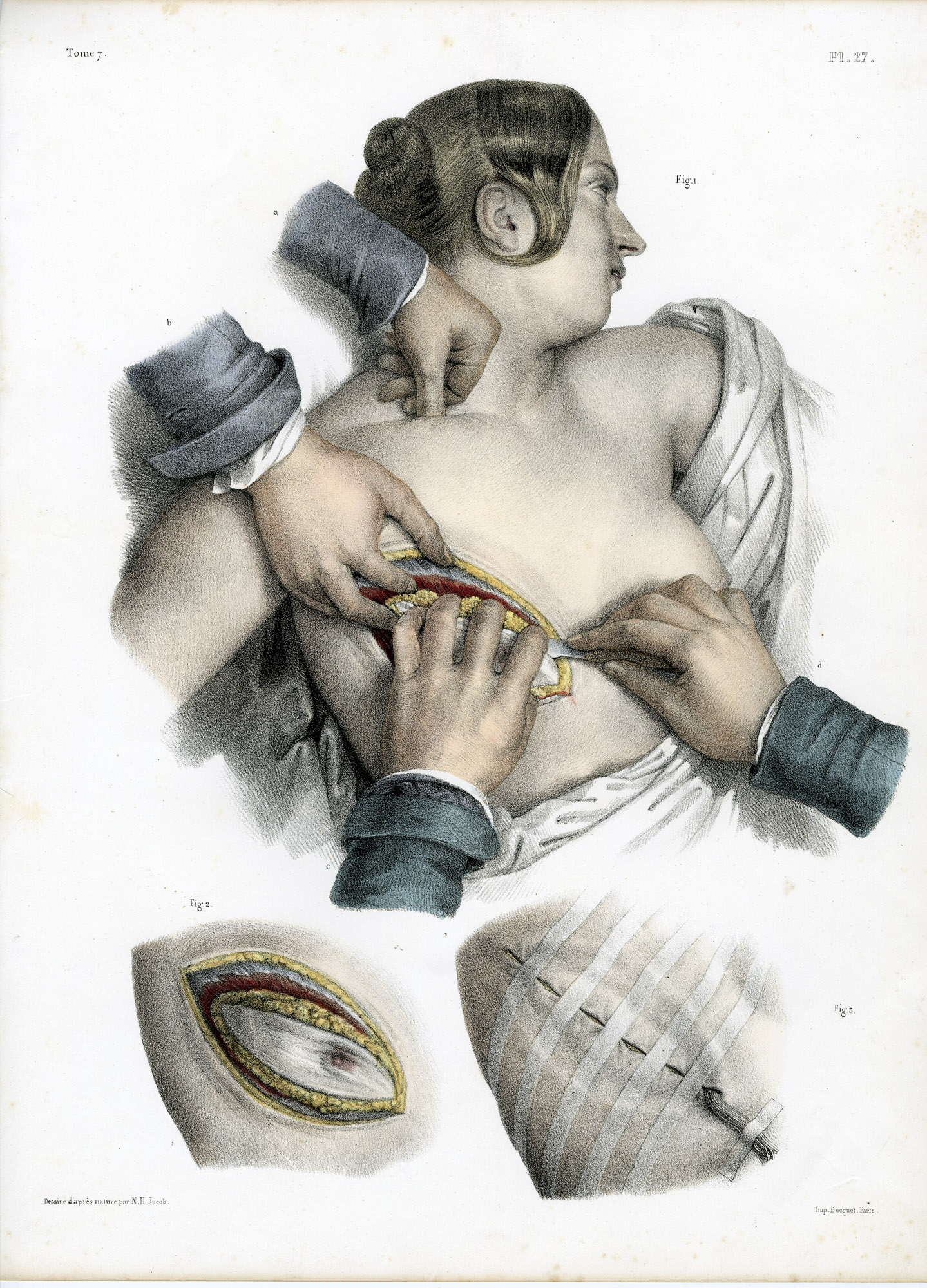 Pictura 14050 416x578 Catalogue-Bourgery-Human anatomy - Image 5
