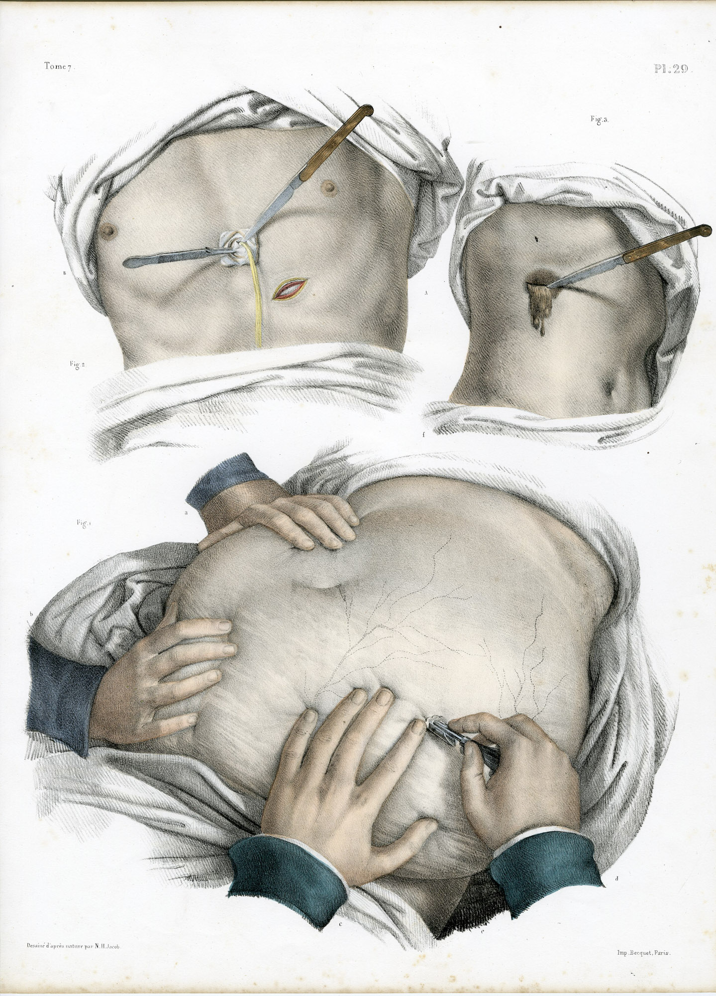 Pictura 14051 416x578 Catalogue-Bourgery-Human anatomy - Image 6