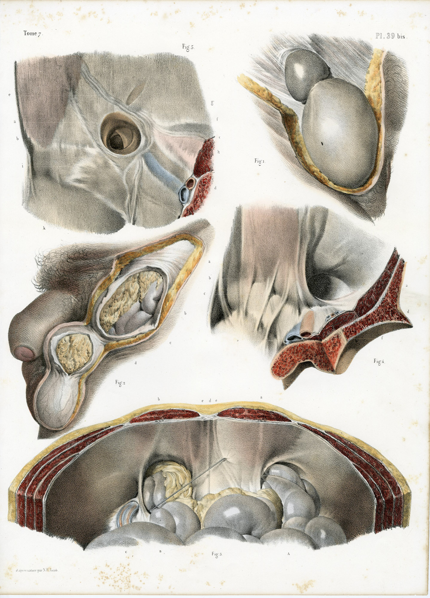 Pictura 14052 416x578 Catalogue-Bourgery-Human anatomy - Image 7