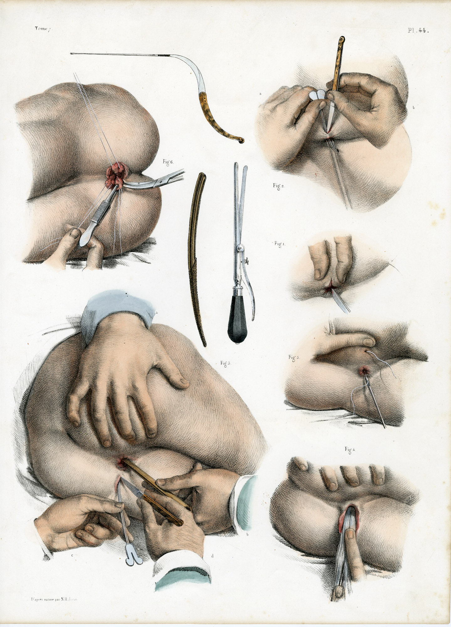 Pictura 14053 416x578 Catalogue-Bourgery-Human anatomy - Image 8