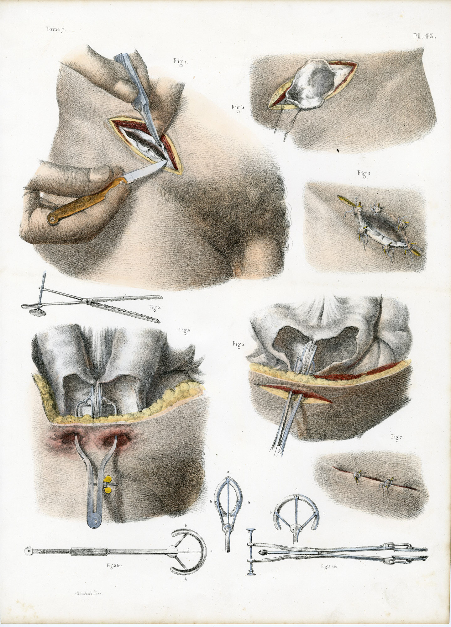 Pictura 14054 416x578 Catalogue-Bourgery-Human anatomy - Image 9