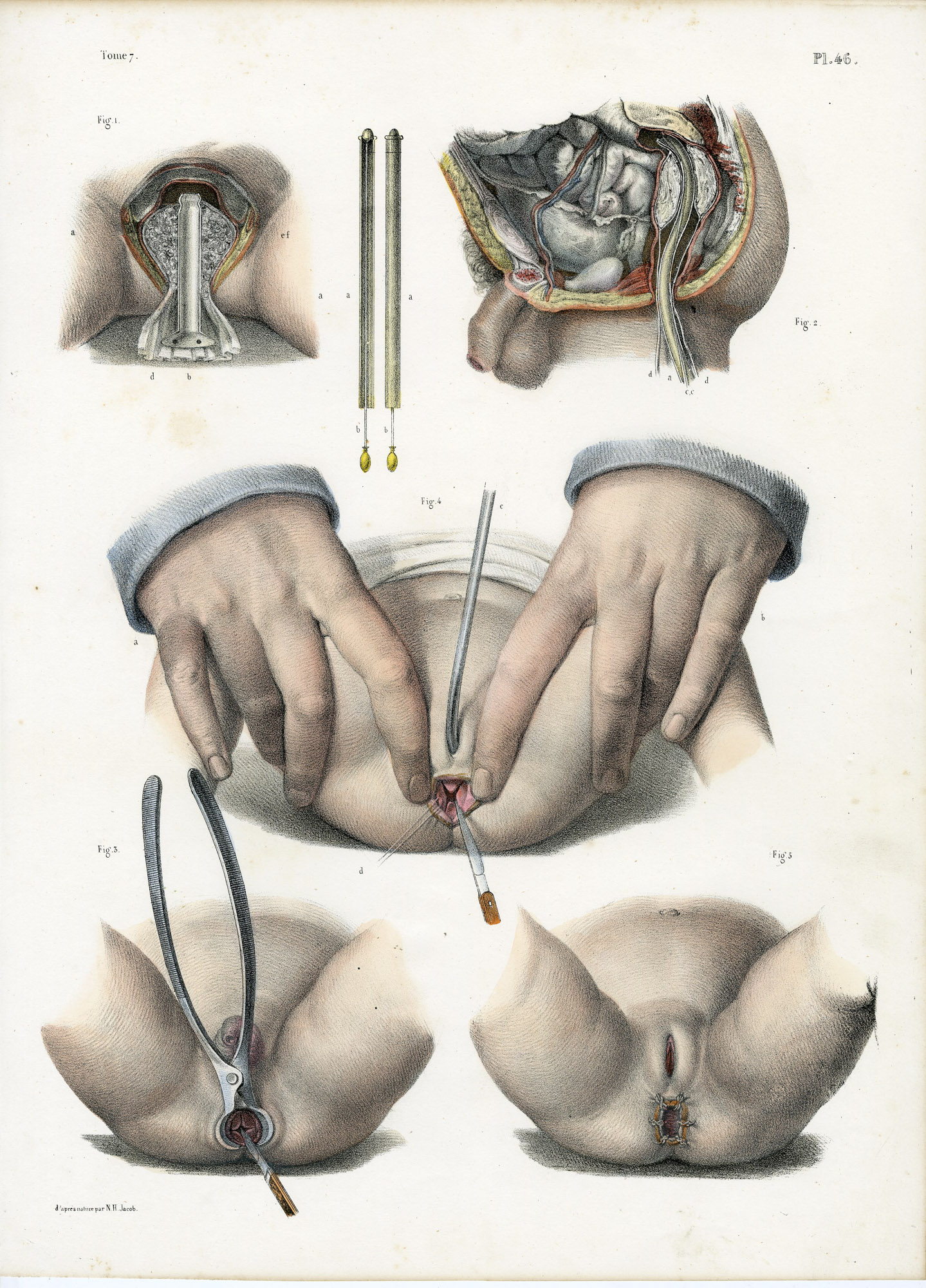 Pictura 14055 416x578 Catalogue-Bourgery-Human anatomy - Image 10
