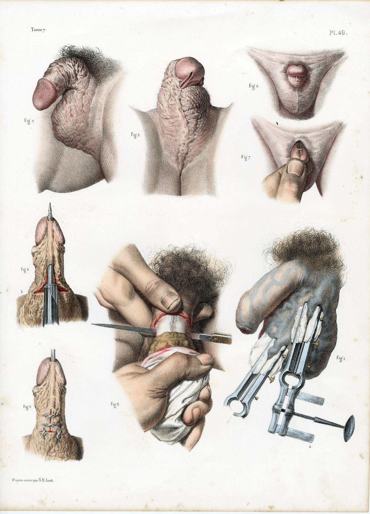 Pictura 14056 416x578 Catalogue-Bourgery-Human anatomy - Image 11