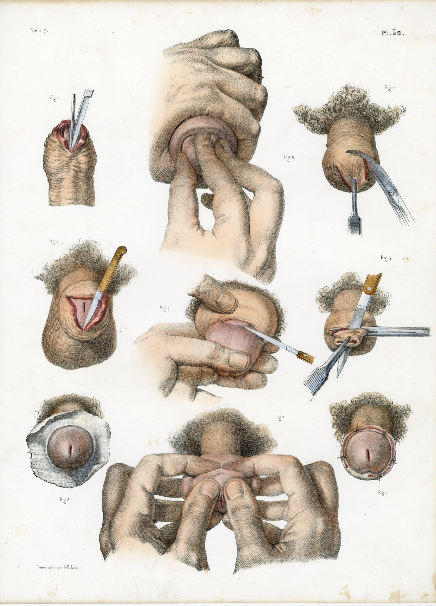 Pictura 14057 416x578 Catalogue-Bourgery-Human anatomy - Image 12