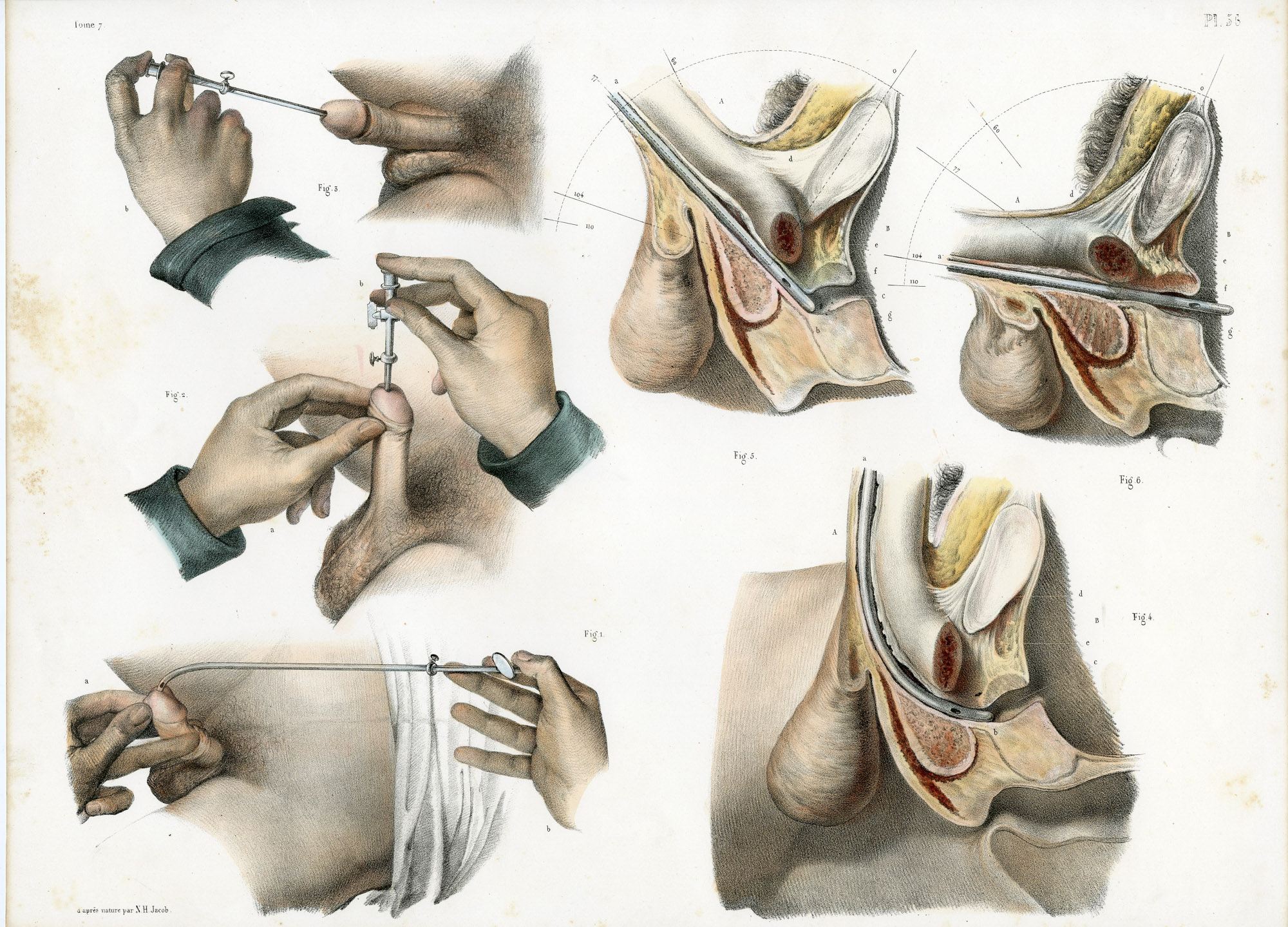 Pictura 14060 416x299 Catalogue-Bourgery-Human anatomy - Image 15