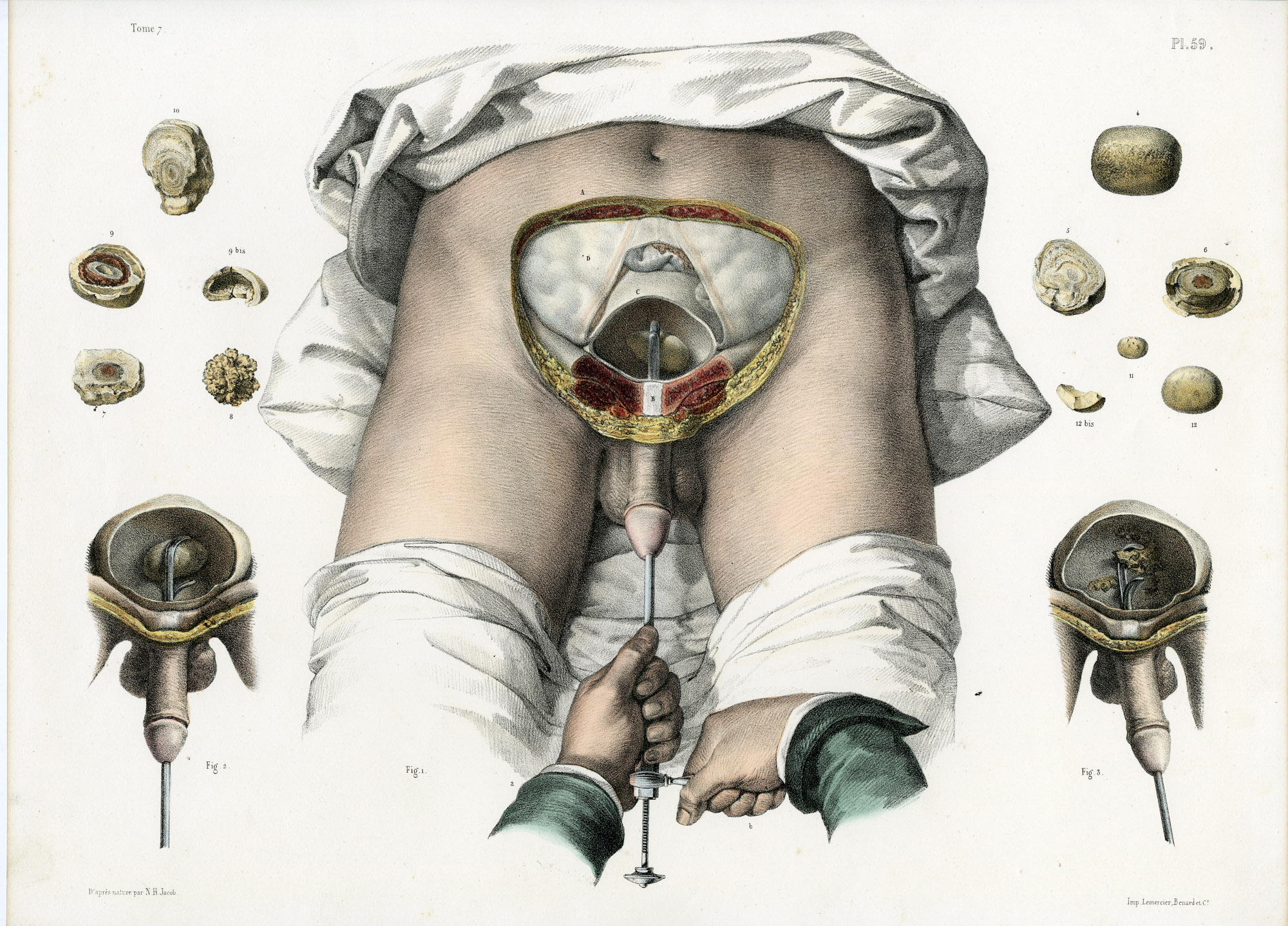 Pictura 14061 416x299 Catalogue-Bourgery-Human anatomy - Image 16