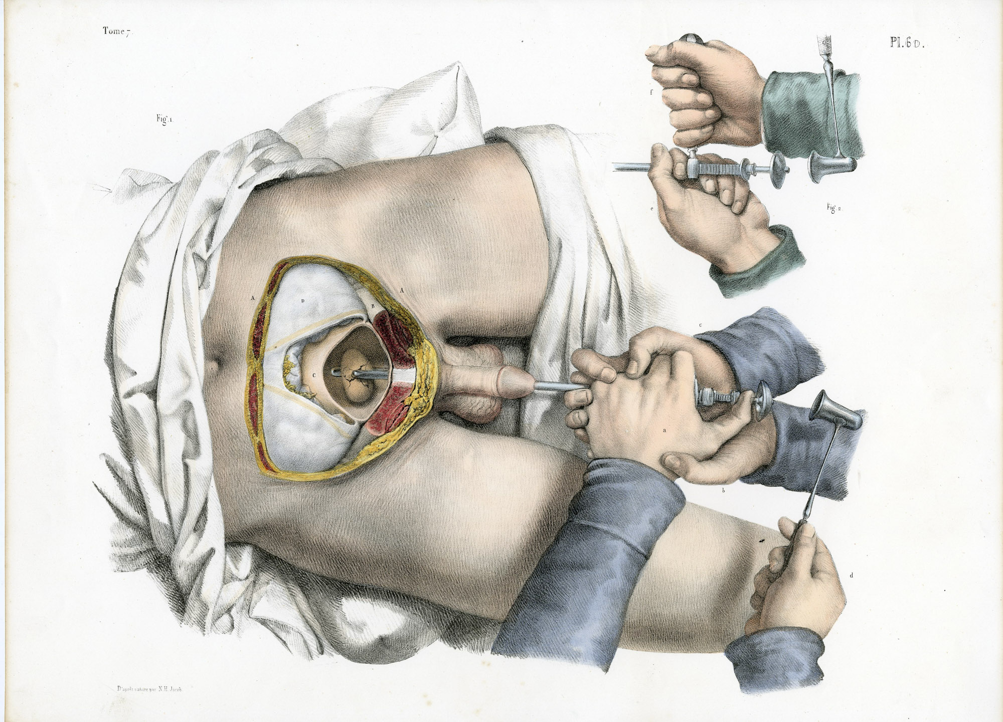 Pictura 14062 416x299 Catalogue-Bourgery-Human anatomy - Image 17