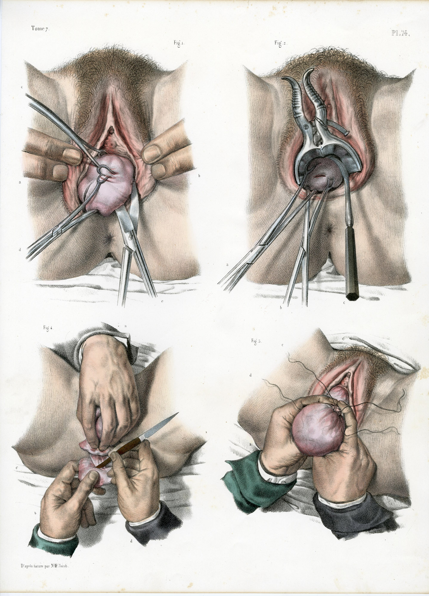 Pictura 14063 416x578 Catalogue-Bourgery-Human anatomy - Image 18