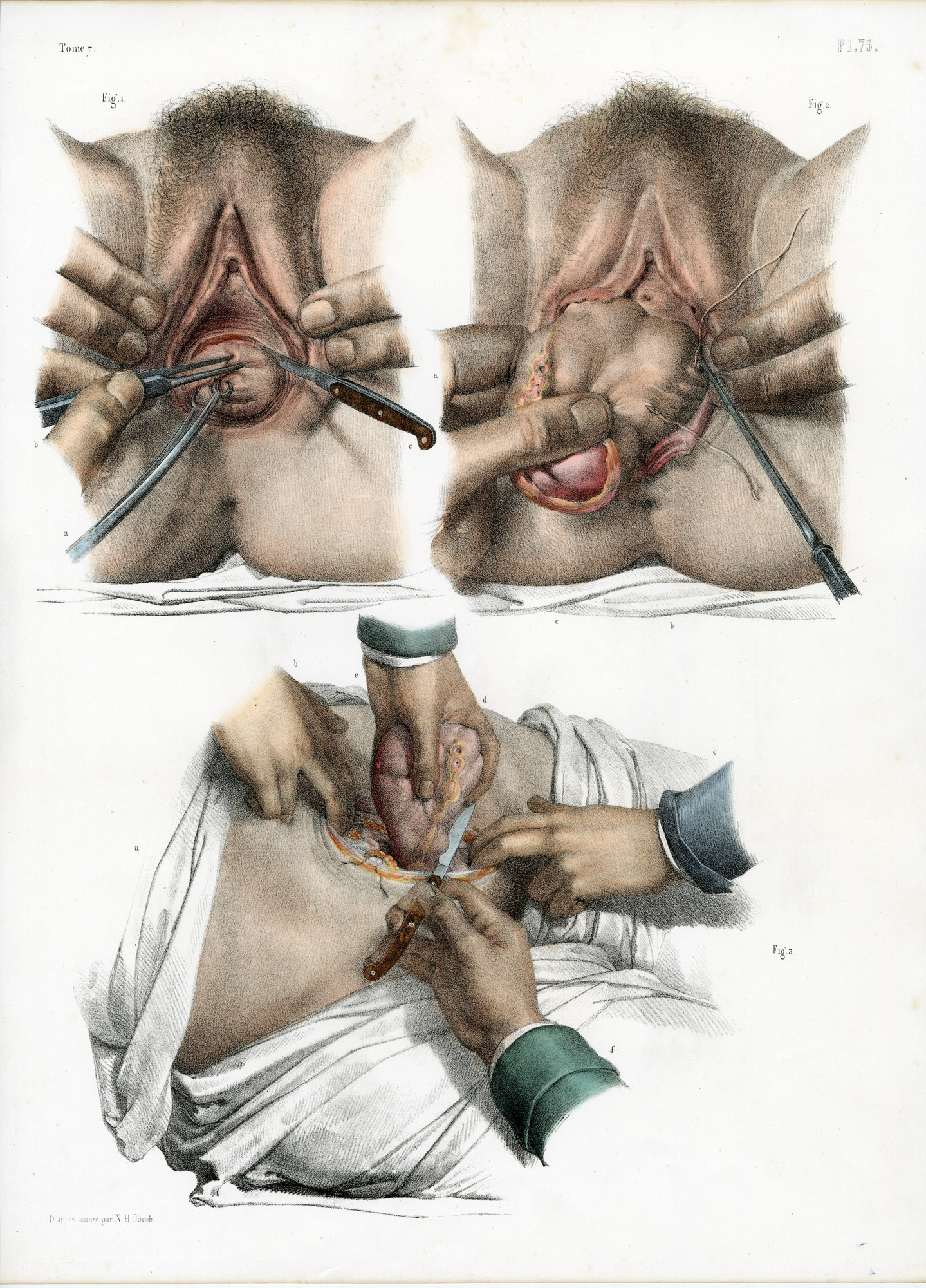 Pictura 14064 416x578 Catalogue-Bourgery-Human anatomy - Image 19