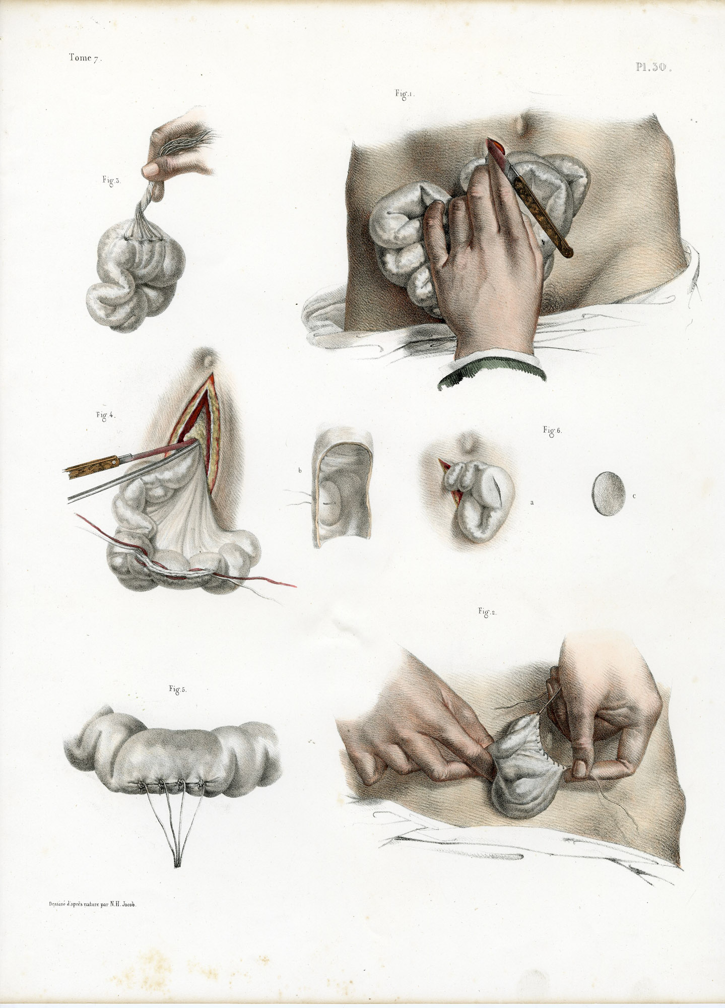Pictura 14066 416x578 Catalogue-Bourgery-Human anatomy - Image 21