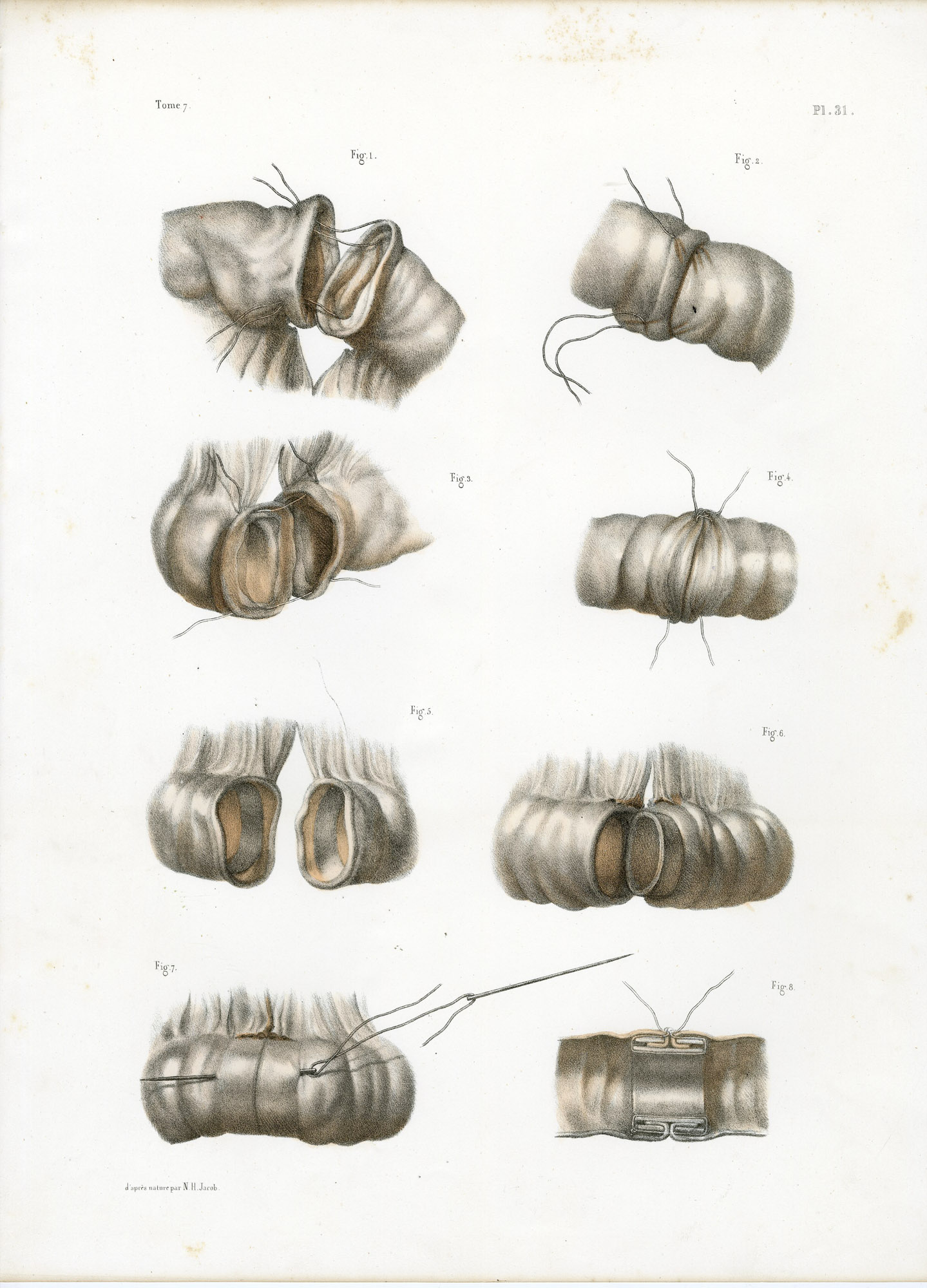 Pictura 14067 416x578 Catalogue-Bourgery-Human anatomy - Image 22