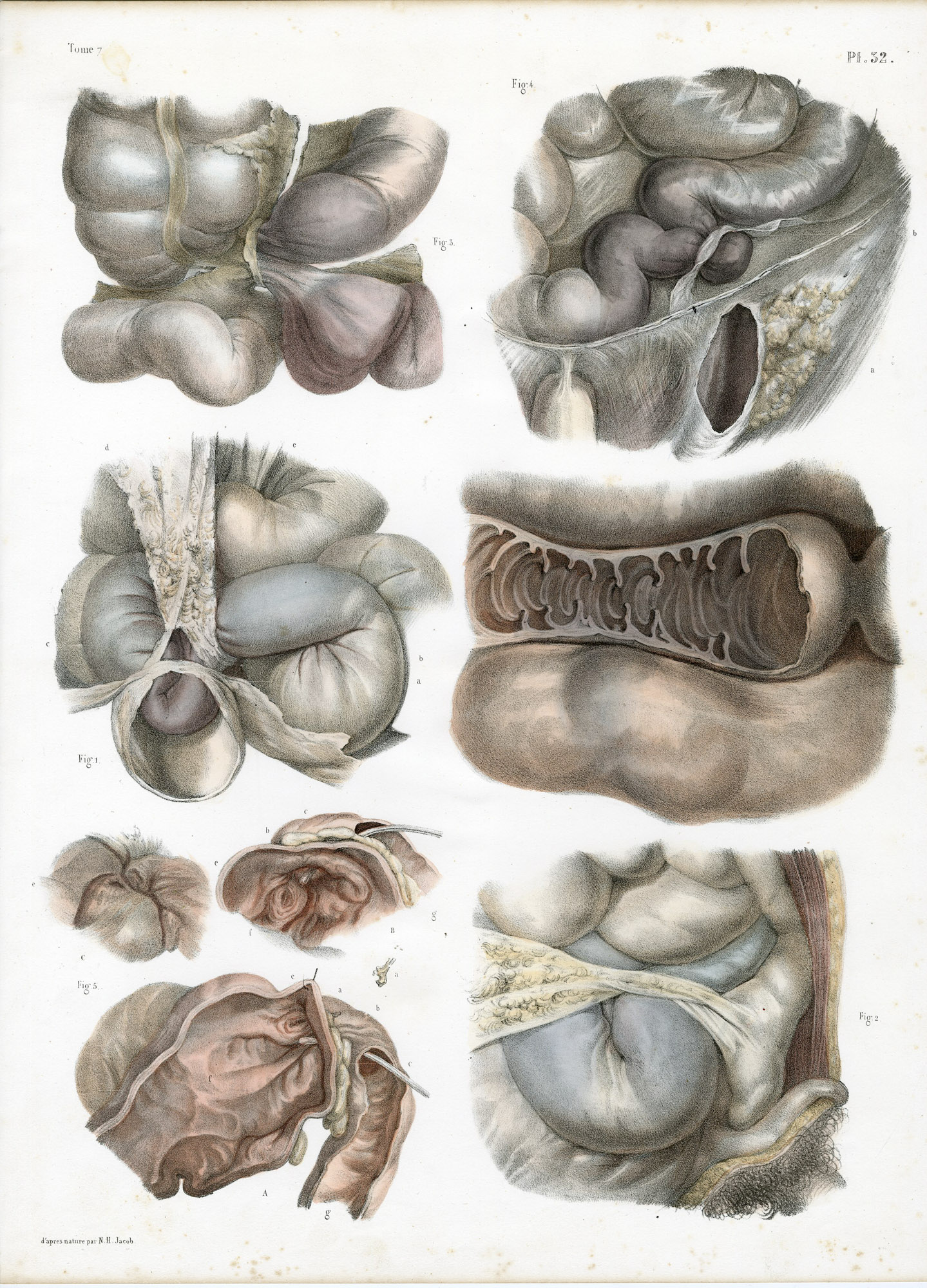 Pictura 14068 416x578 Catalogue-Bourgery-Human anatomy - Image 23