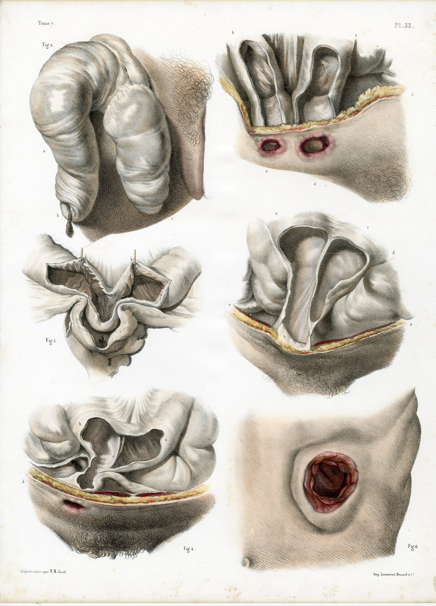 Pictura 14069 416x578 Catalogue-Bourgery-Human anatomy - Image 24