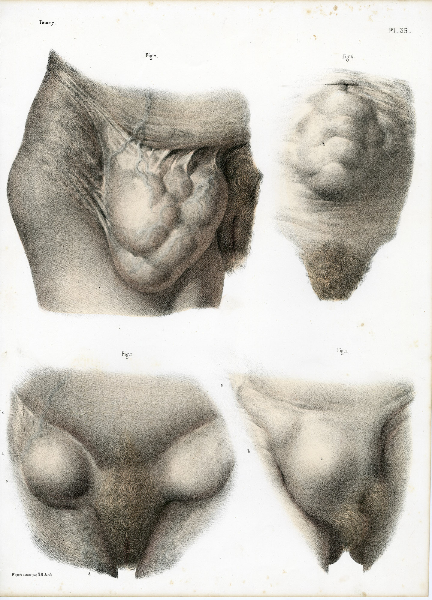 Pictura 14071 416x578 Catalogue-Bourgery-Human anatomy - Image 26
