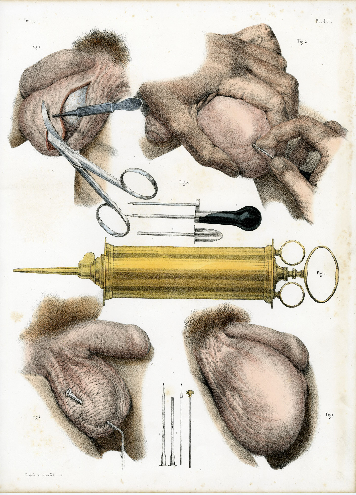 Pictura 14074 416x578 Catalogue-Bourgery-Human anatomy - Image 29