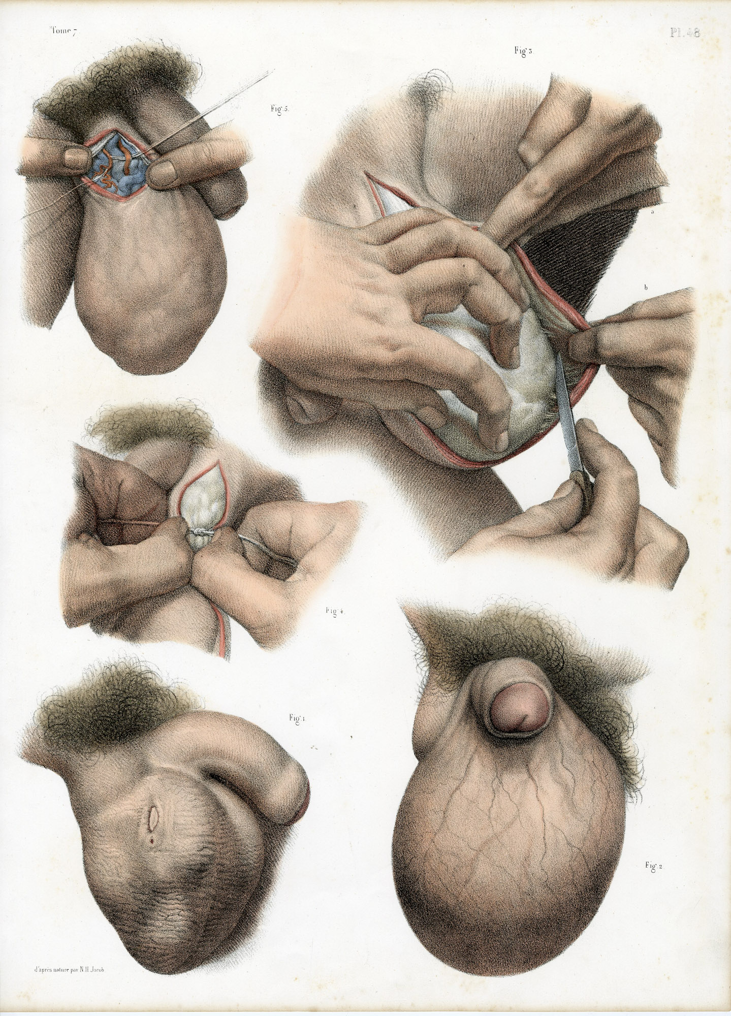 Pictura 14075 416x578 Catalogue-Bourgery-Human anatomy - Image 30