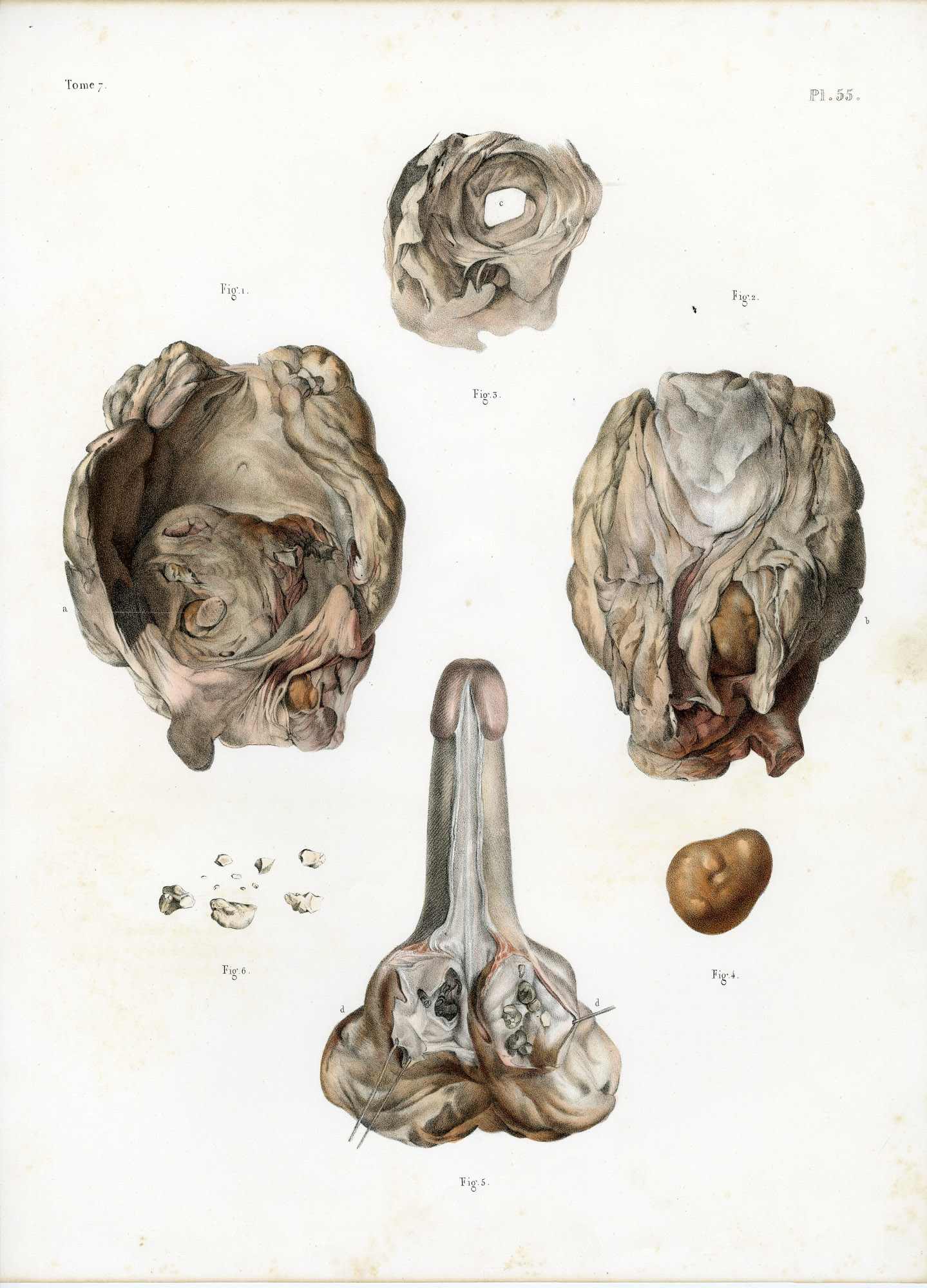 Pictura 14076 416x578 Catalogue-Bourgery-Human anatomy - Image 31