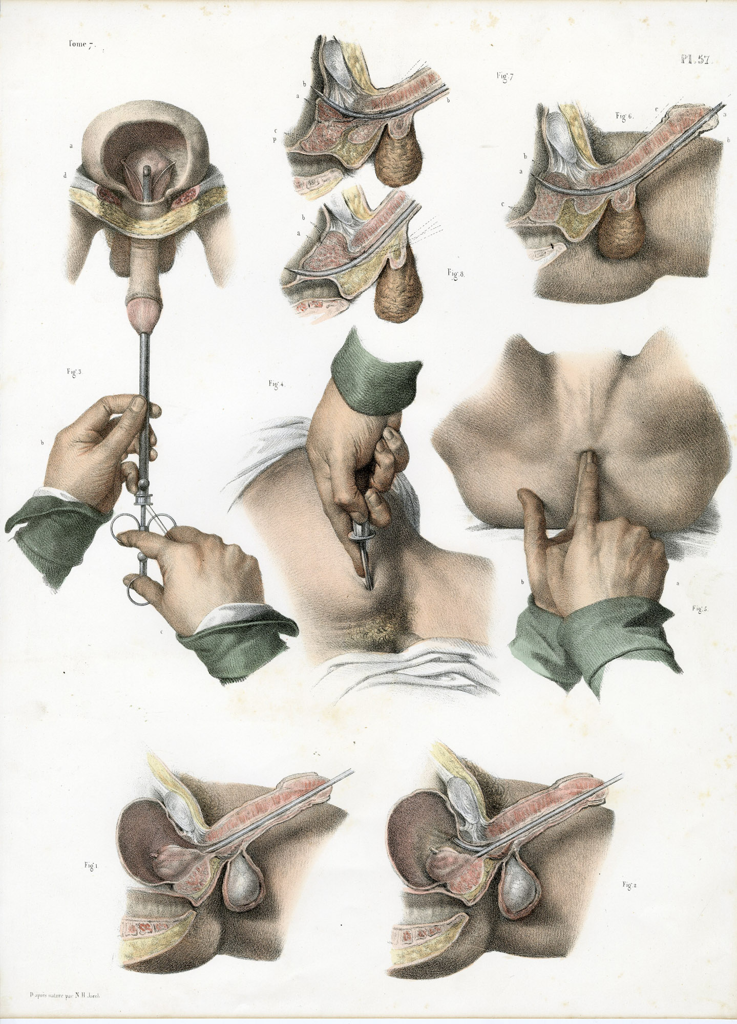 Pictura 14077 416x578 Catalogue-Bourgery-Human anatomy - Image 32
