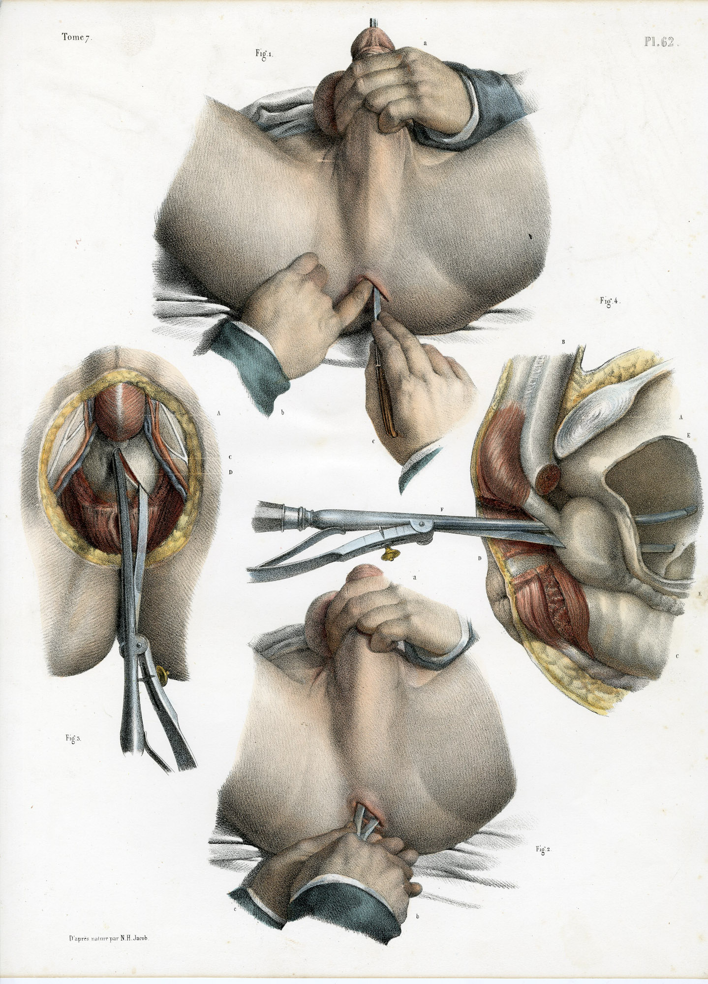 Pictura 14079 416x578 Catalogue-Bourgery-Human anatomy - Image 34