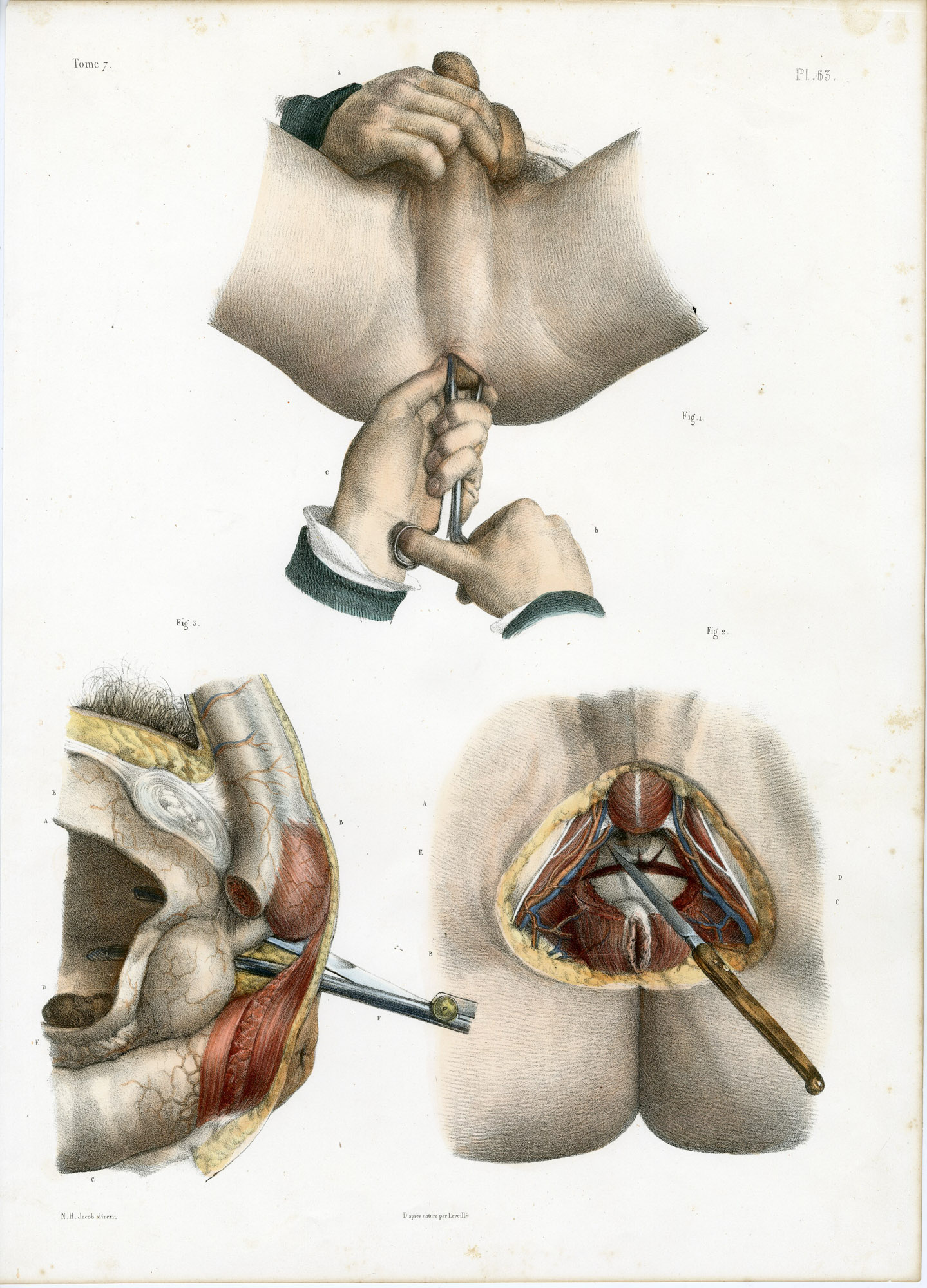 Pictura 14080 416x578 Catalogue-Bourgery-Human anatomy - Image 35
