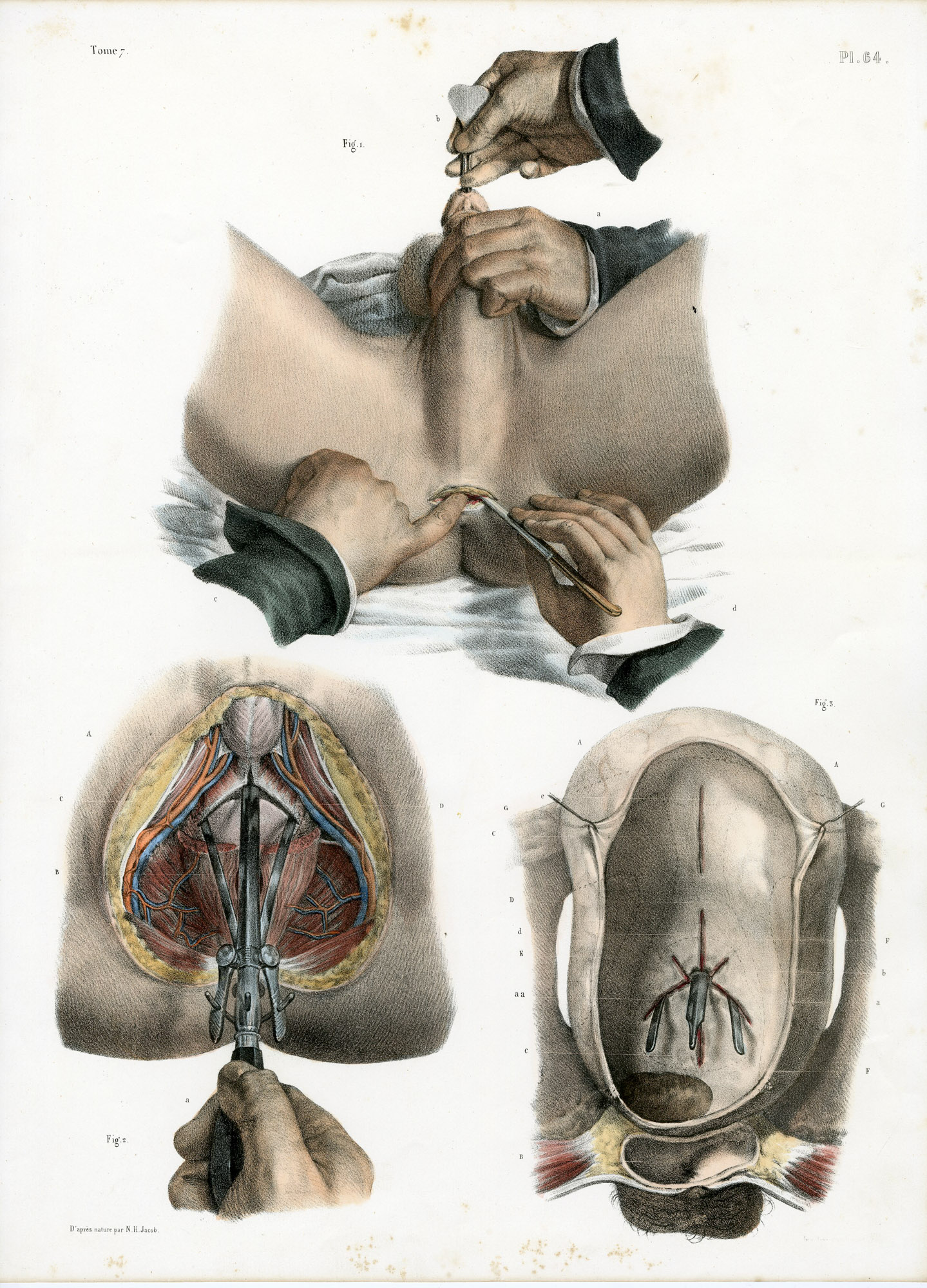 Pictura 14081 416x578 Catalogue-Bourgery-Human anatomy - Image 36