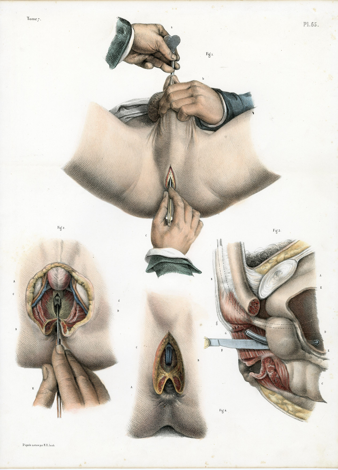Pictura 14082 416x578 Catalogue-Bourgery-Human anatomy - Image 37