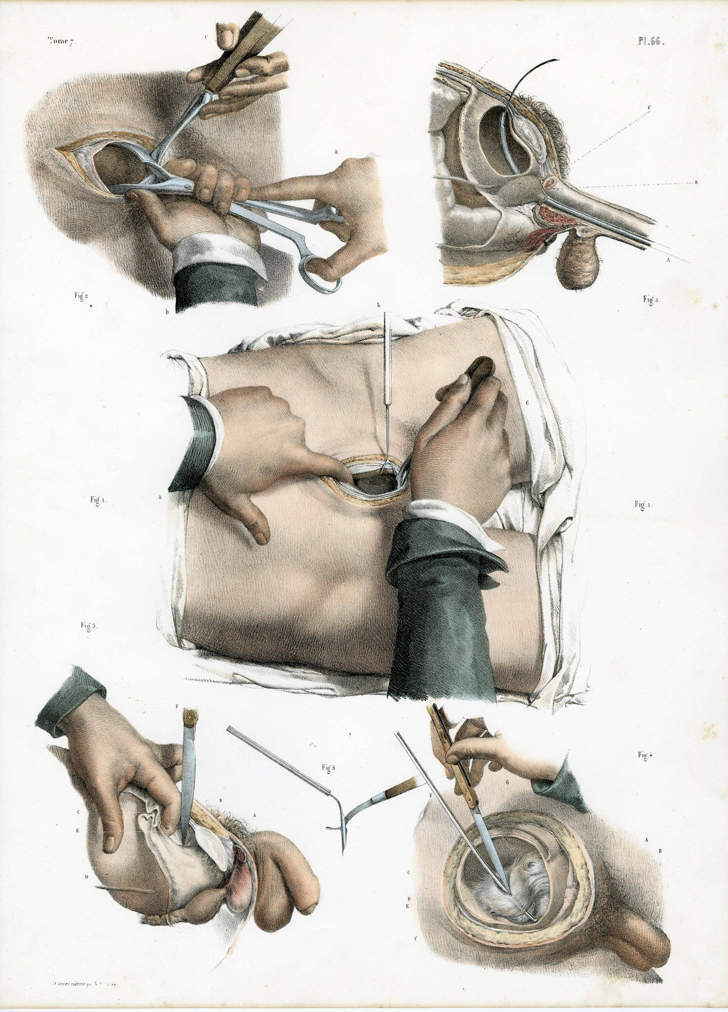Pictura 14083 416x578 Catalogue-Bourgery-Human anatomy - Image 38