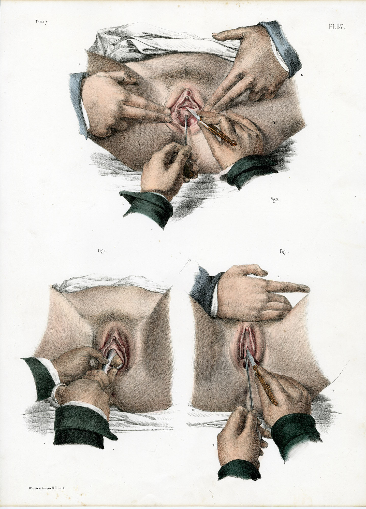 Pictura 14084 416x578 Catalogue-Bourgery-Human anatomy - Image 39