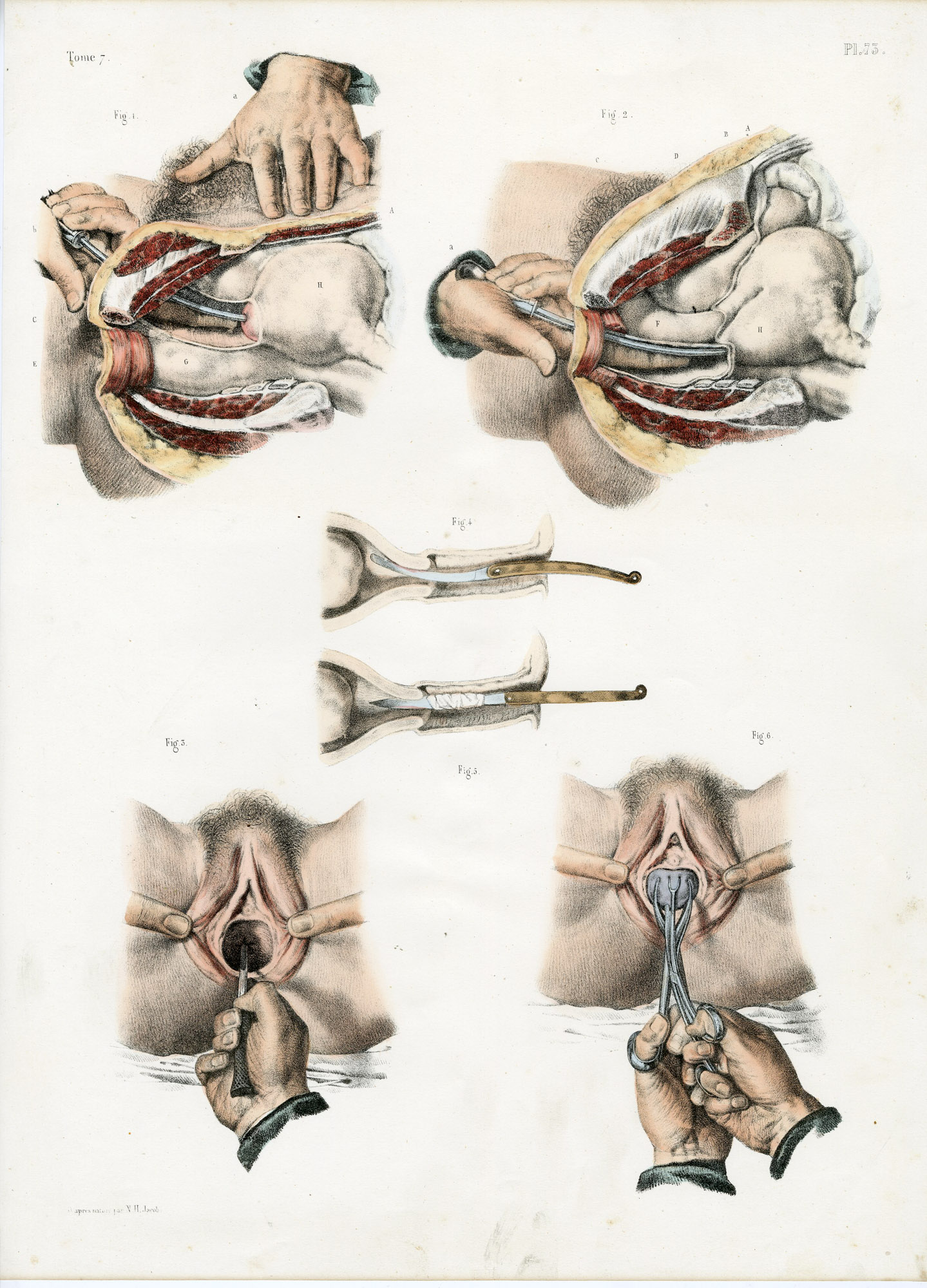 Pictura 14088 416x578 Catalogue-Bourgery-Human anatomy - Image 43