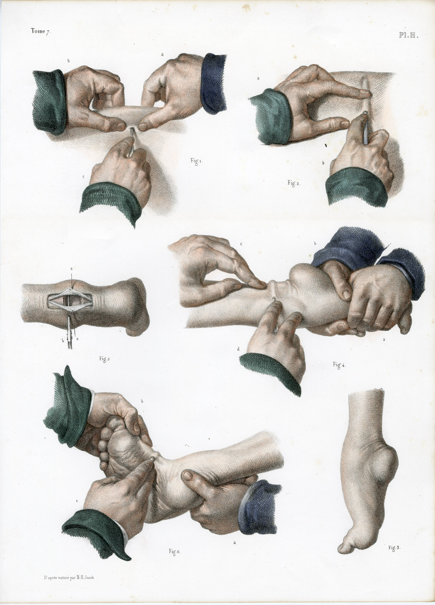 Pictura 14089 416x578 Catalogue-Bourgery-Human anatomy - Image 44