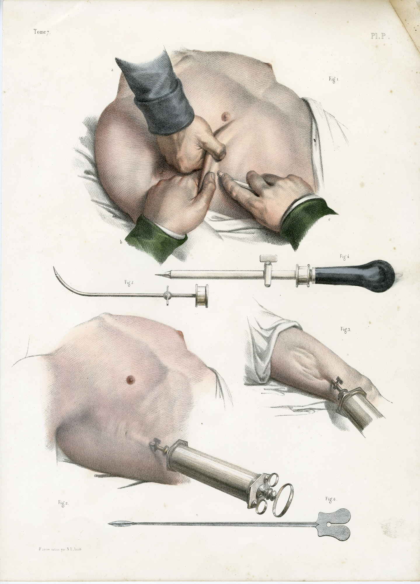 Pictura 14090 416x578 Catalogue-Bourgery-Human anatomy - Image 45