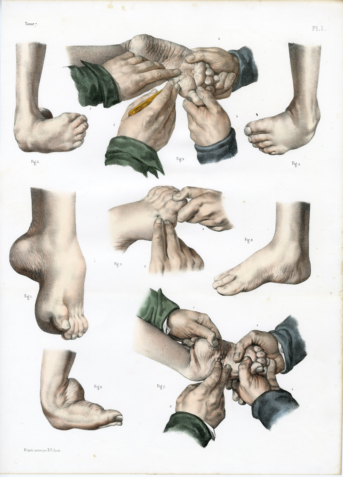Pictura 14091 416x578 Catalogue-Bourgery-Human anatomy - Image 46