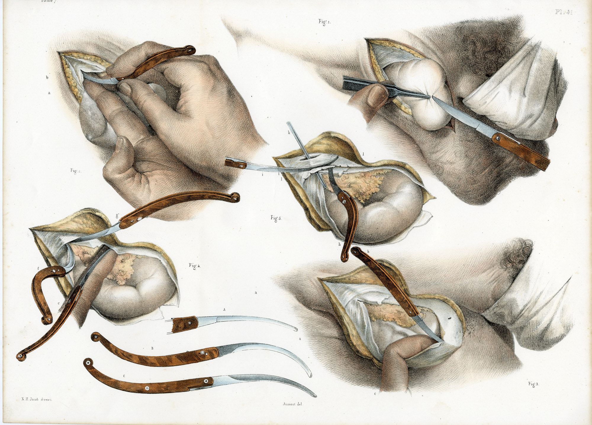 Pictura 14093 416x299 Catalogue-Bourgery-Human anatomy - Image 48