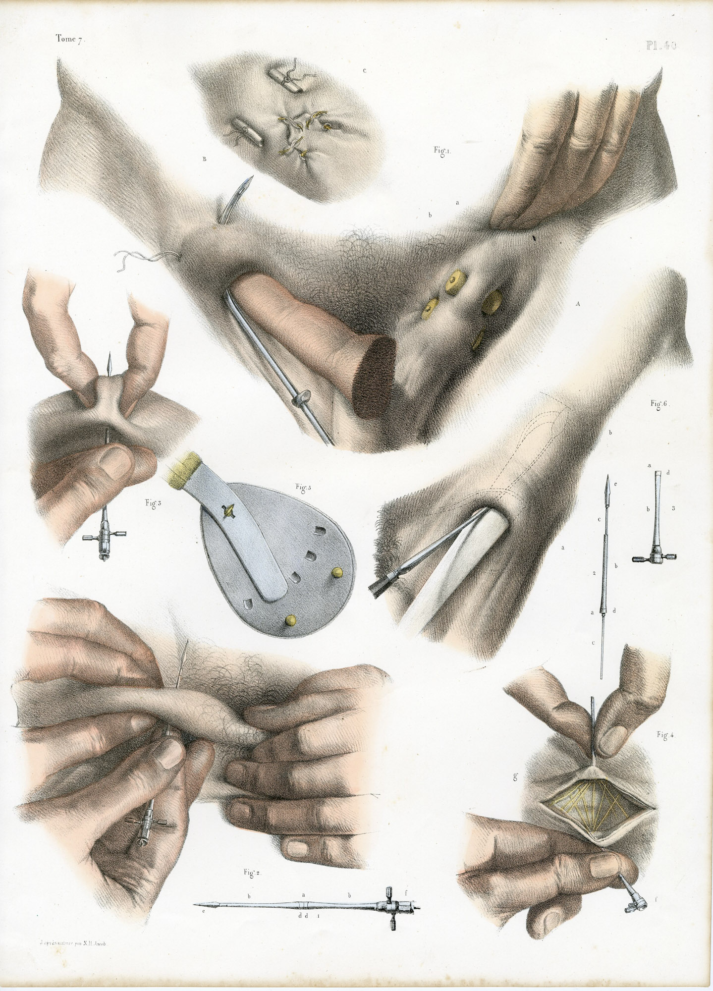 Pictura 14094 416x578 Catalogue-Bourgery-Human anatomy - Image 49
