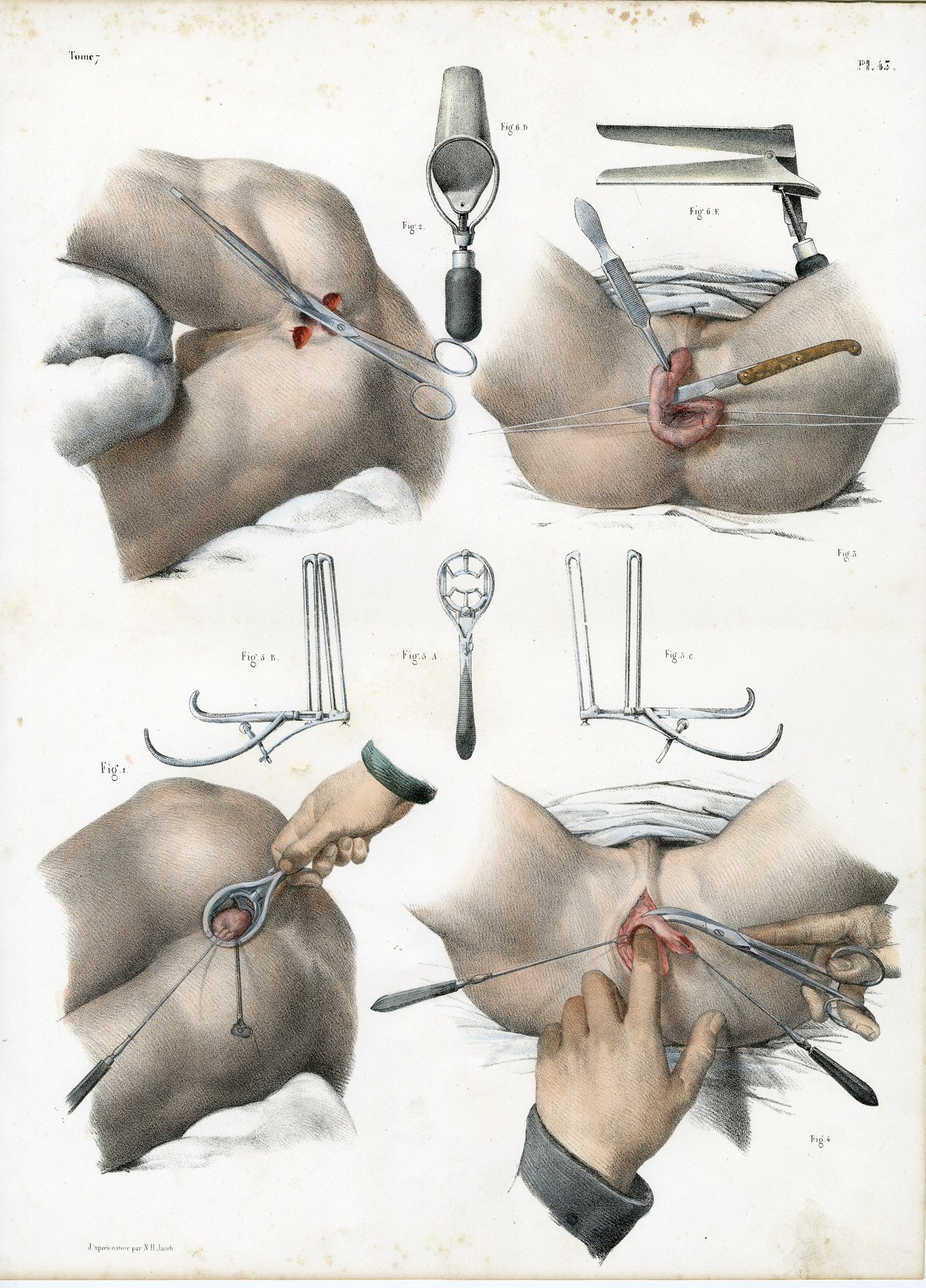 Pictura 14095 416x578 Catalogue-Bourgery-Human anatomy - Image 50