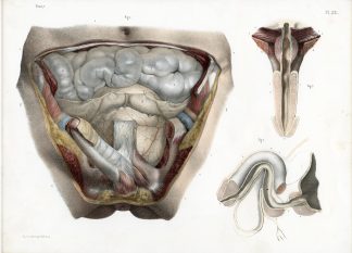 Antique Print-SURGERY-MALE URINARY TRACT-PENIS-INSTRUMENTS-Jacob-Bourgery-1831